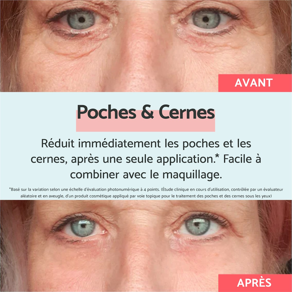 FR Eyebags Dark Circles Product Images2