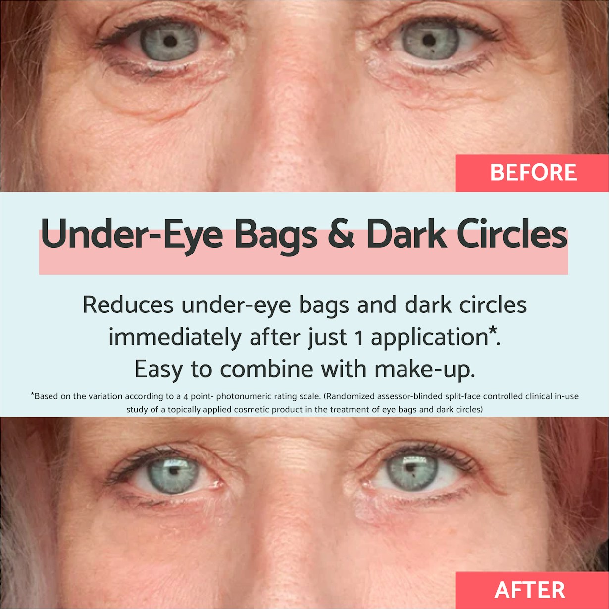 UK Eyebags Dark Circles Product Images3