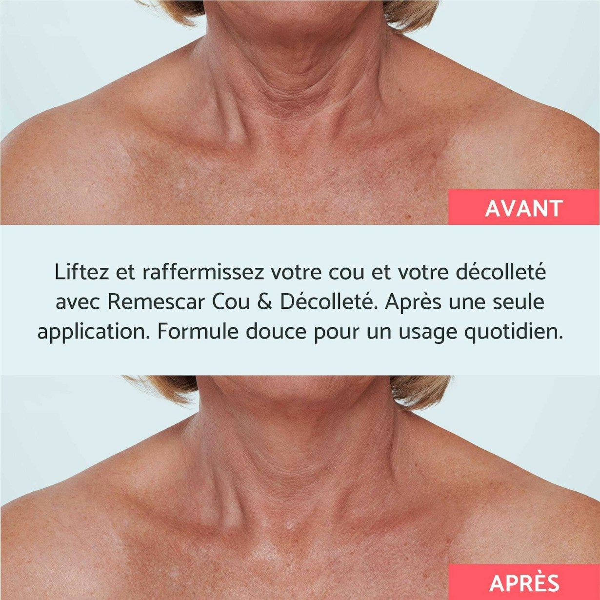 Remescar pdp pictures website and amazon 2000x2000px instant neck and decollete FR3