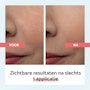 Remescar Pore Reducer productpage NL