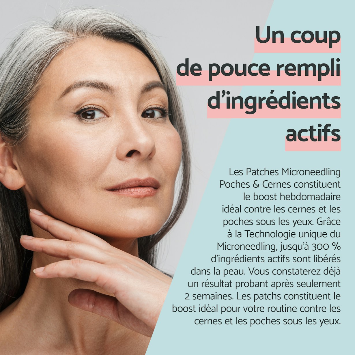 Remescar | Patches Microneedling Poches & Cernes